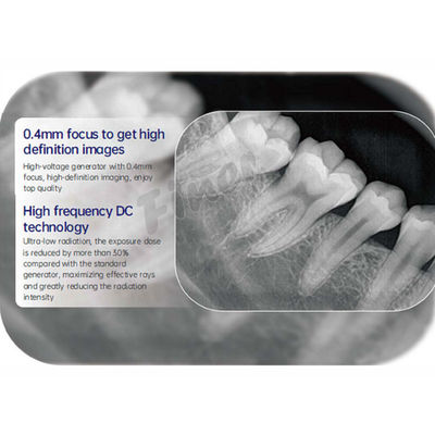 Mesin Sinar X Digital Dental Intraoral Lanjutan Dengan Sensor Resolusi Tinggi