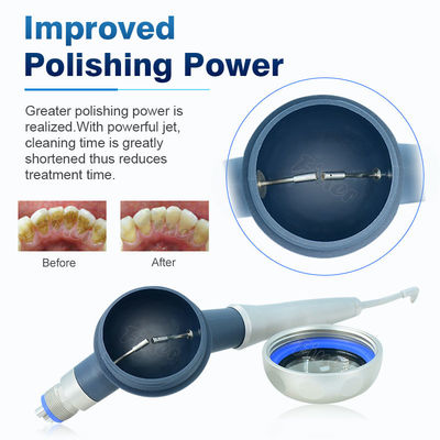 SS Dental Air Prophy Mate Pembersihan Gigi Pemutih Terapi Airpolishing Sistem Pemolesan Gigi