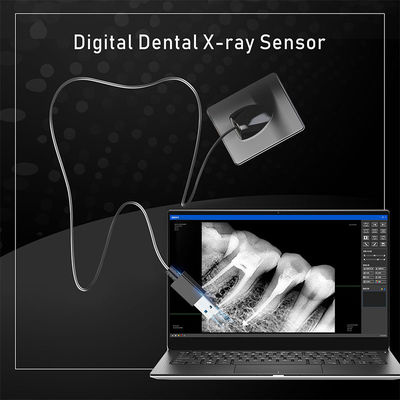 Dental X-Ray Digital Sensor Untuk Implan Gigi Dan Pengobatan Endodontik