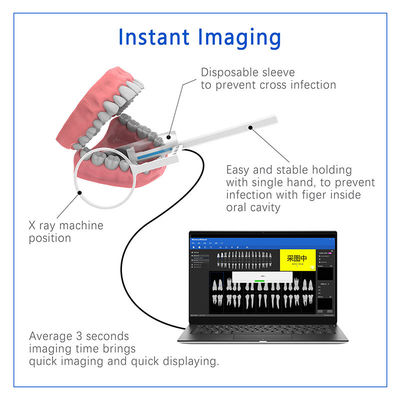Dental X-Ray Digital Sensor Untuk Implan Gigi Dan Pengobatan Endodontik