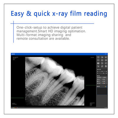 Dental X-Ray Digital Sensor Untuk Implan Gigi Dan Pengobatan Endodontik