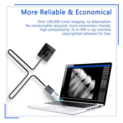 Dental X-Ray Digital Sensor Untuk Implan Gigi Dan Pengobatan Endodontik